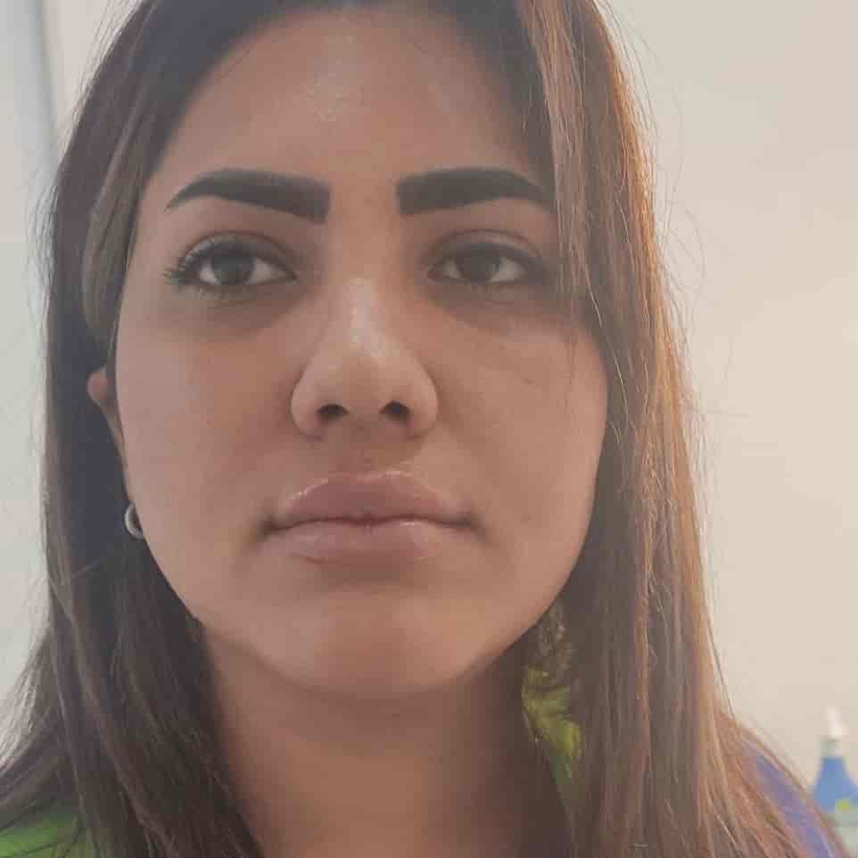 عمل سانترال لب در گرگان