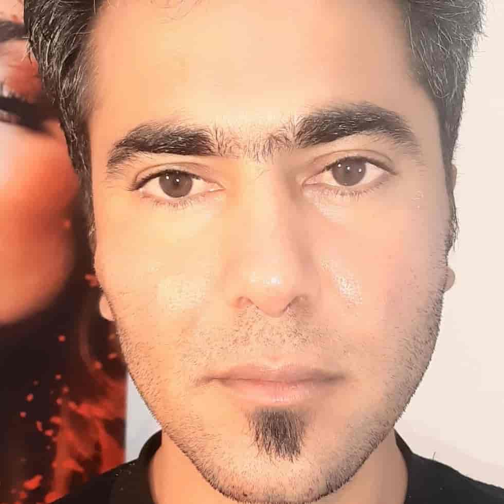 زاویه سازی صورت و چانه و گونه در گرگان