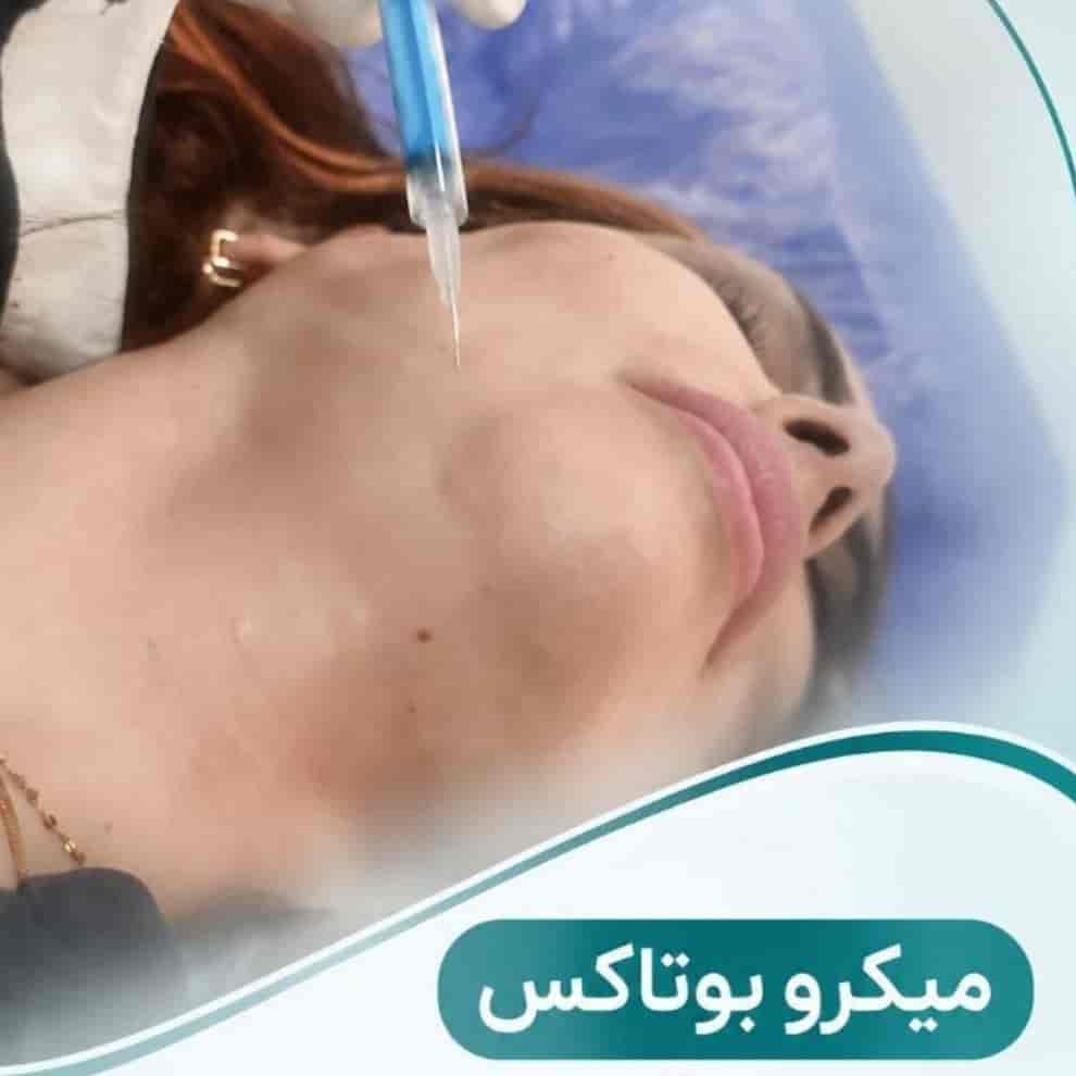 میکرو بوتاکس صورت و گردن در گرگان