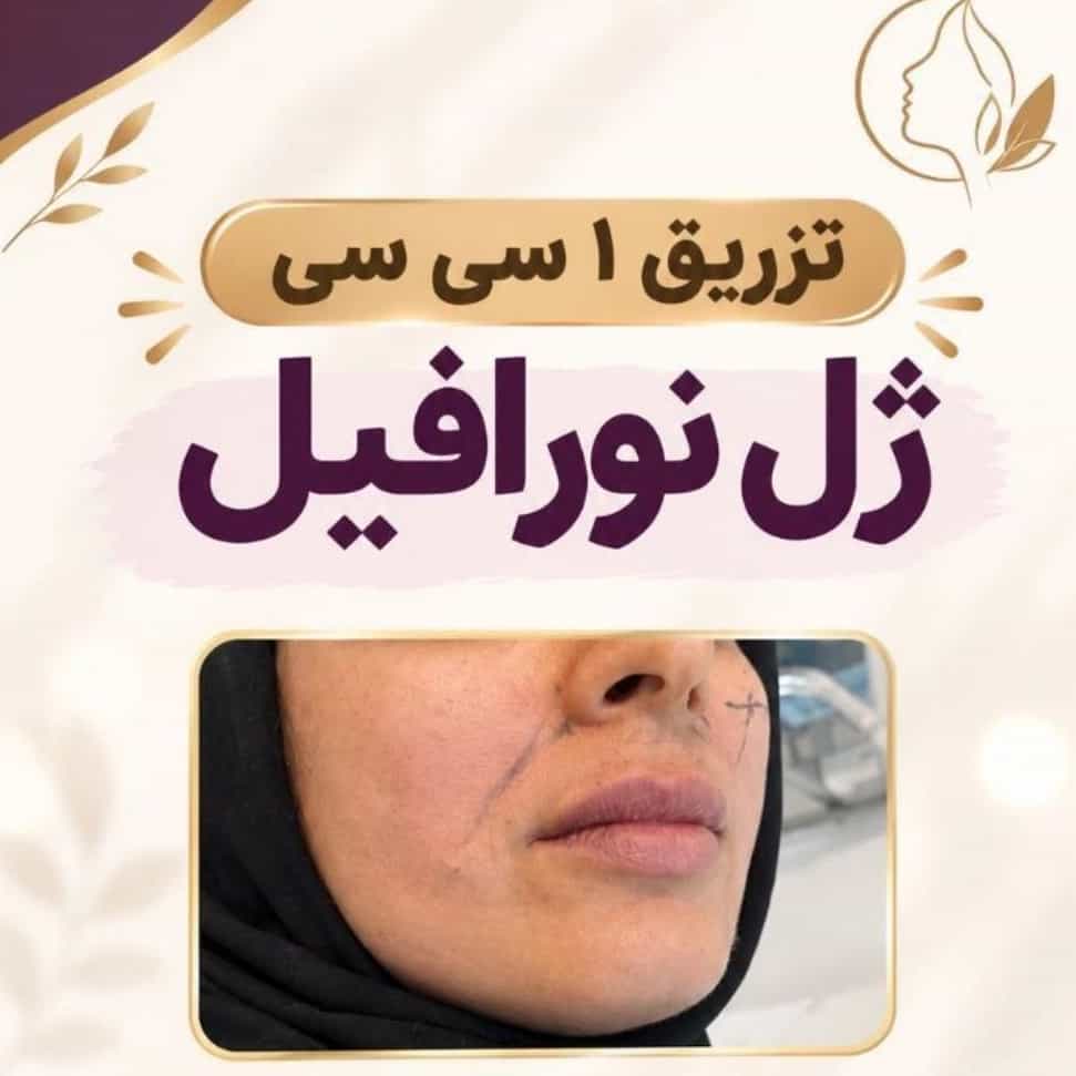 1791014089723.webp