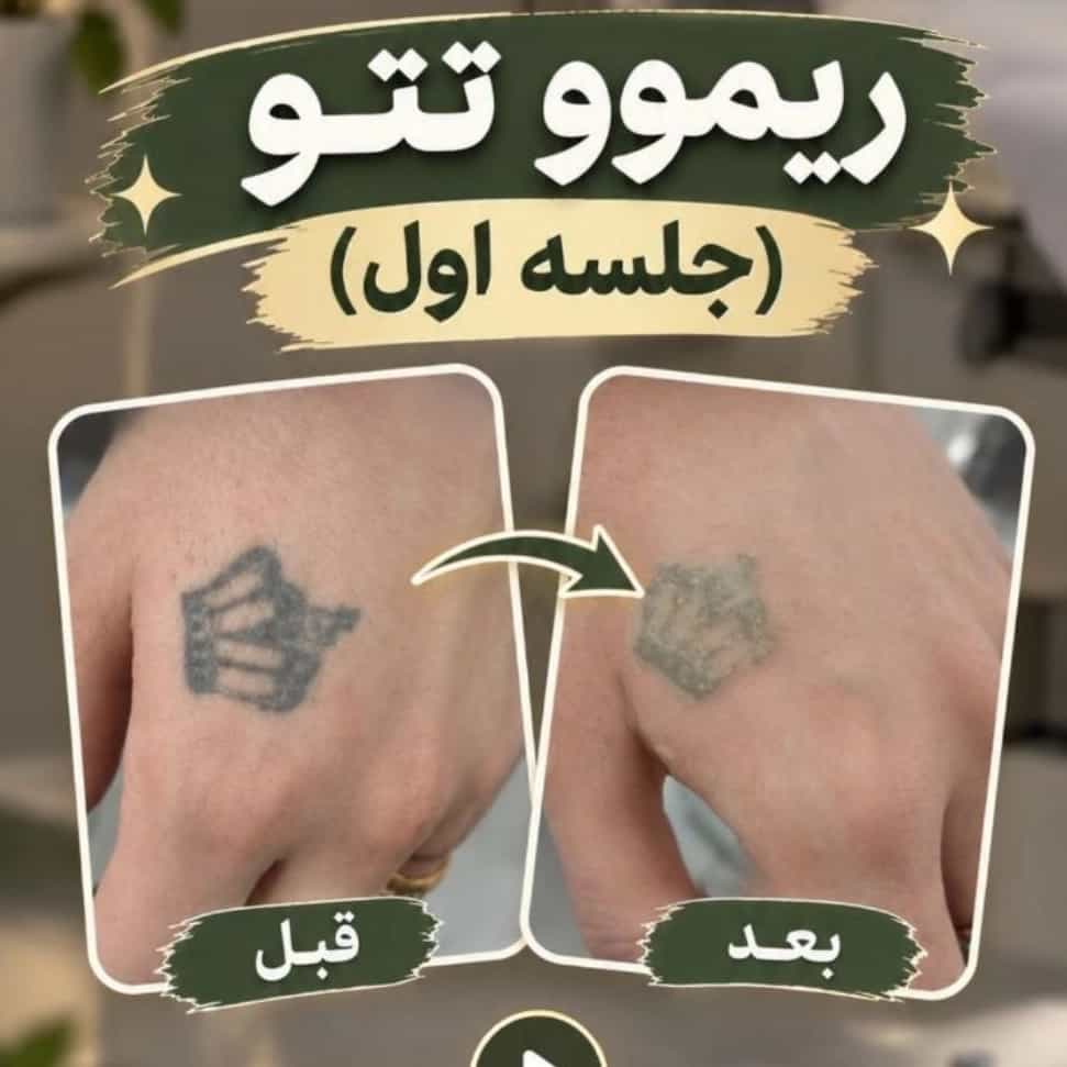 1792663847016.webp