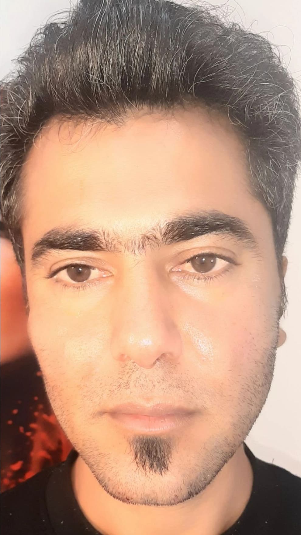 زاویه سازی چانه
