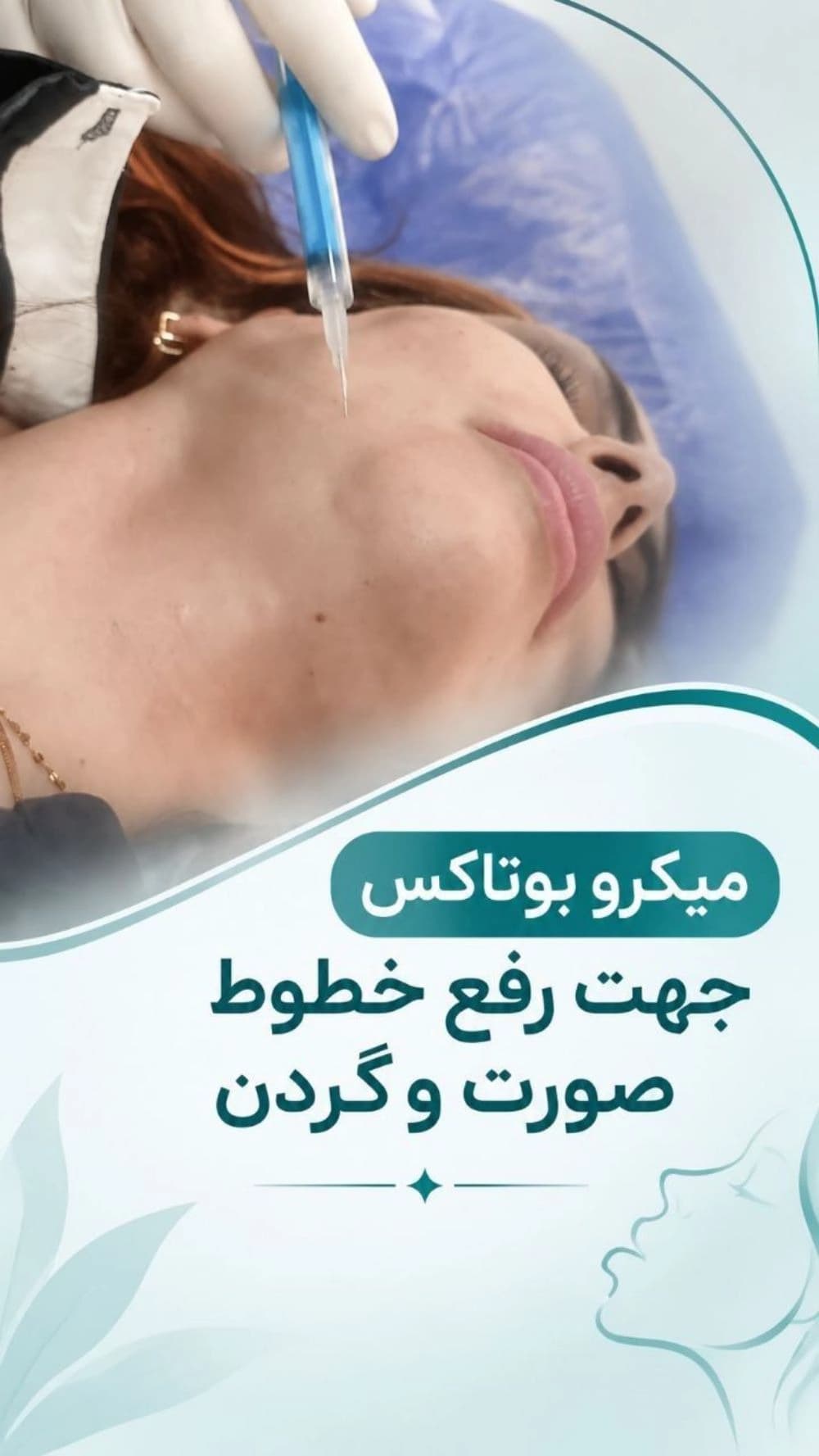 میکرو بوتاکس صورت و گردن